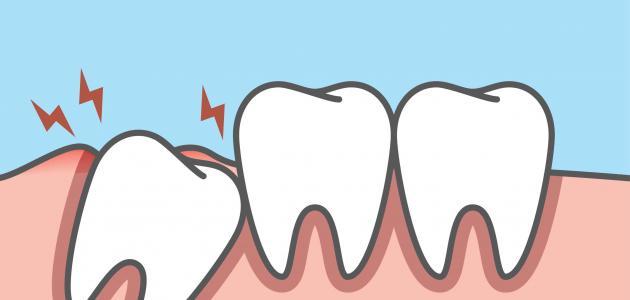 كيفية علاج ألم الأسنان في المنزل