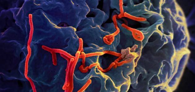 ما هو فيروس الإيبولا وعلاجه ؟