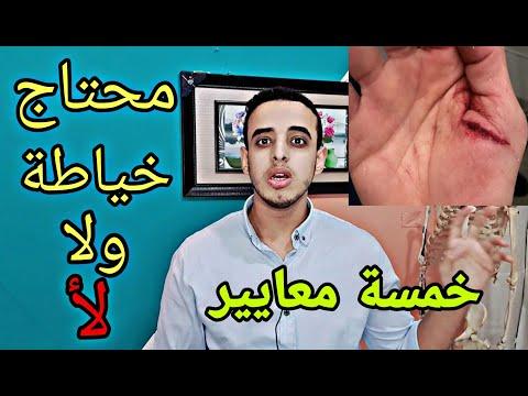 كيف تعرف إذا كان الجرح يحتاج خياطة أم لا؟ 5 علامات ستساعدك على اتخاذ القرار 