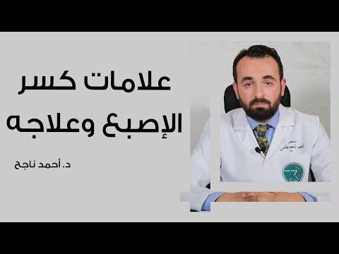 علامات كسر الاصبع وعلاجه 