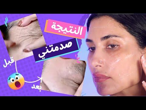 شد البشرة من غير عملية و لا ابر مع خيوط الكولاجين و البروتين النتيجة صدمتني 