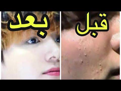 أشكال اعضاء Bts قبل و بعد عمليات التجميل 