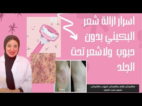 أفضل طريقة لإزالة شعر البيكيني بدون بثور أو بقع 