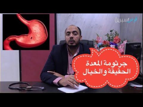 بكتيريا المعدة بين الحقيقة والخيال 