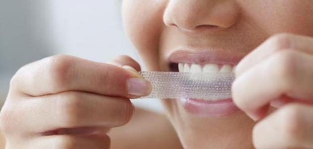 أضرار أنواع لصقات تبييض الأسنان