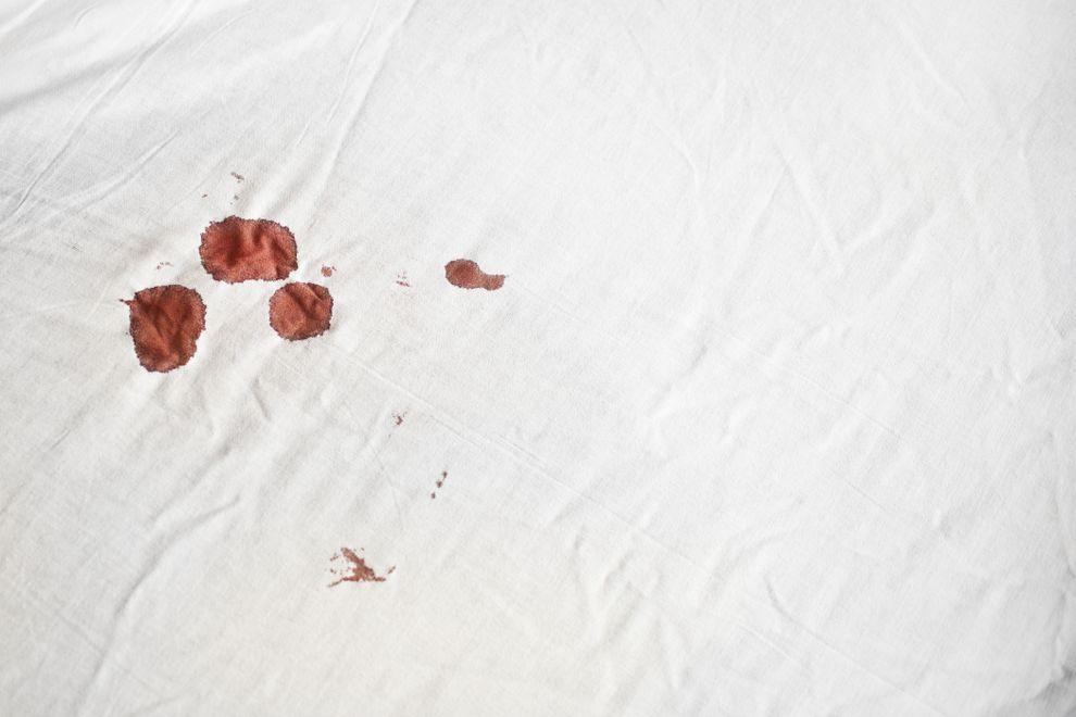 كيف أزيل بقع الدم عن الملابس