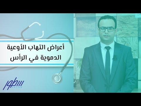 أعراض التهاب الأوعية الدموية في الرأس 