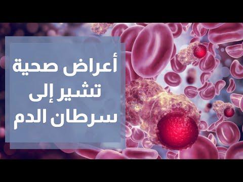 الأعراض الصحية التي تشير إلى سرطان الدم 