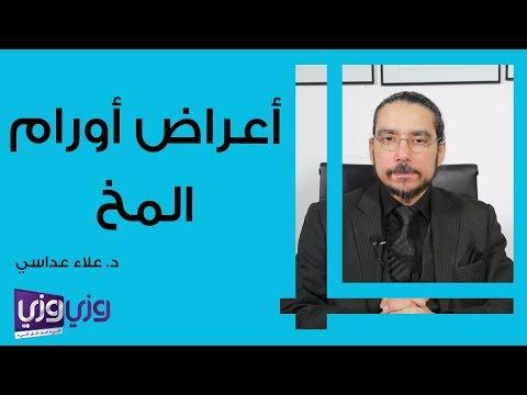 أعراض ورم الدماغ 