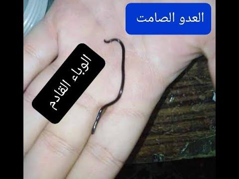 مش هتصدقوا لقيت ايه عندى فى البيت الباح الدودى 