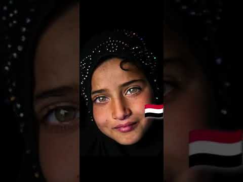 çocuk Güzelliği تحدي جمال الب سطاء أطفال اليمن ضد أطفال تركيا Yemen Türkiye 
