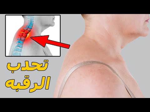 سنام الرقبة، سنام الرقبة، الأسباب والعلاج بدون أدوات، من المنزل، وتحدي. استخدم النوم لعلاج سنام الرقبة. 