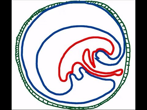 Results Of Folding Of Embryonic Disc DR SAMEH GHAZY 