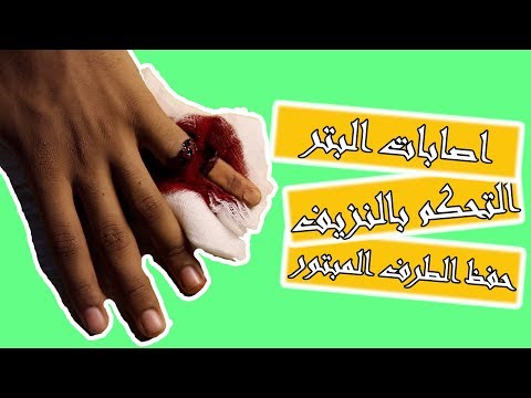 بتر إصابات البتر 