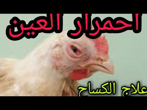 علاج الكساح واحمرار العين 