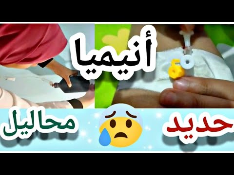 ازاي تعلق المحلول في المنزل الحديد للأنيميا 