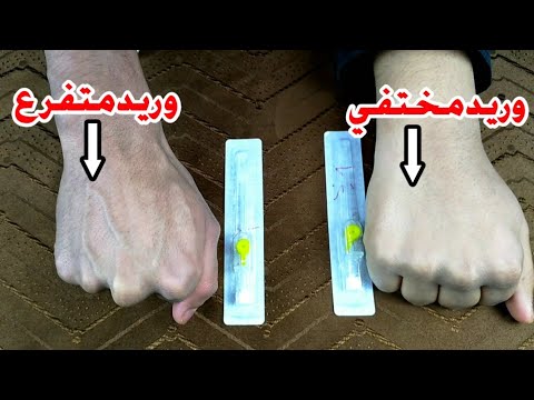 تعلم تركيب الكانيولا في الاورده المتفرعه والاورده المختفيه Cannula In Branched And Non Visible Veins 