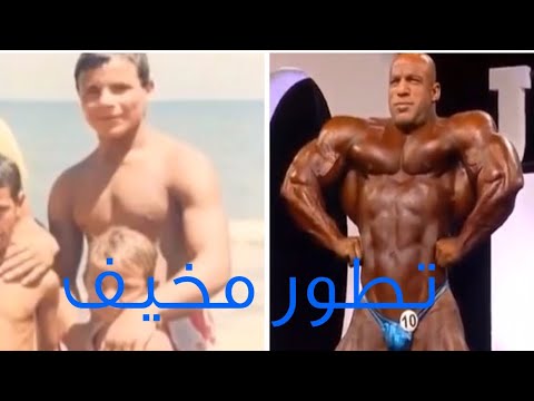 مسيرة بيج رامي قبل وبعد تطور مخيف 