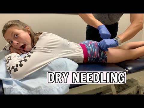 Gymnast Gets DRY NEEDLING For The First Time Does It Hurt 